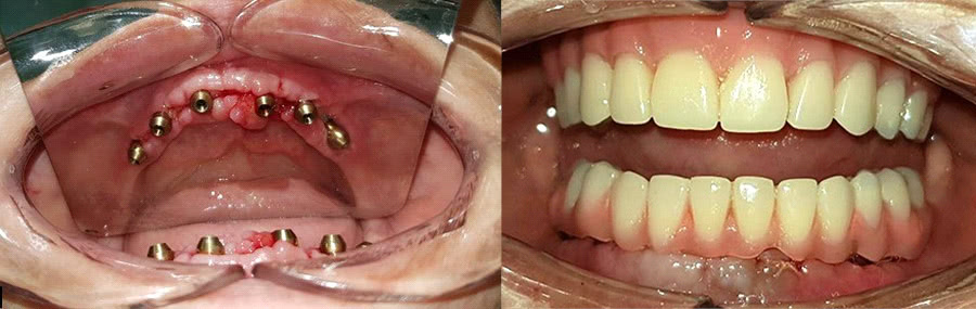лечение и протезирование зубов в томске